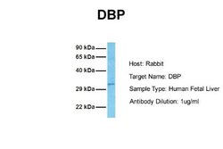 D Box Binding Protein Rabbit anti-Human, Polyclonal, Novus Biologicals